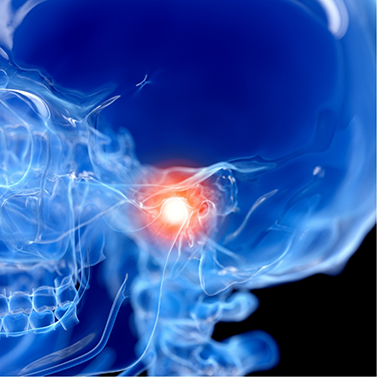 Dental X ray with jaw joint highlighted