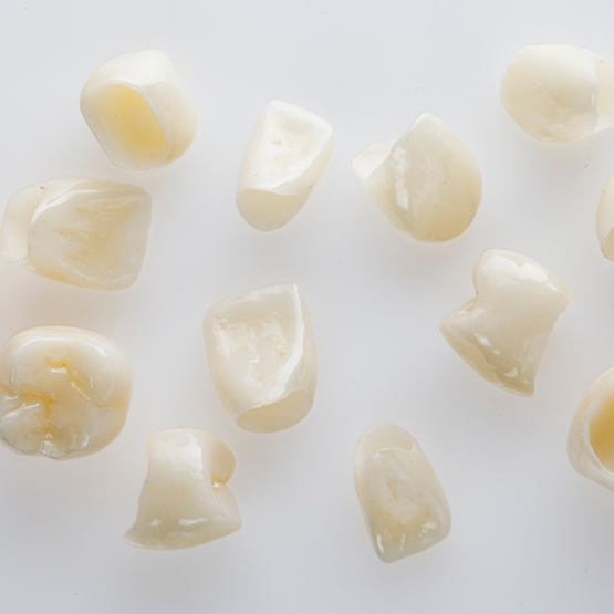 Multiple tooth-colored dental crowns on white surface